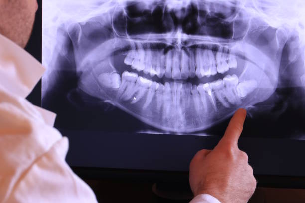 Best Emergency Dentist for Knocked-Out Tooth in Pocono Springs, PA